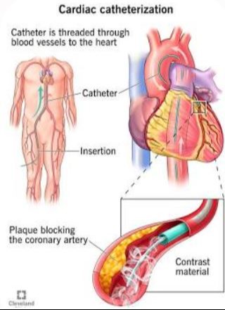 Interventional Cardiologist in Jalandhar 